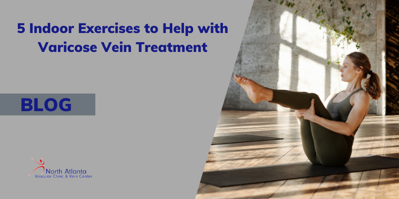 Exercise and Physical Activity for Varicose Vein Relief
