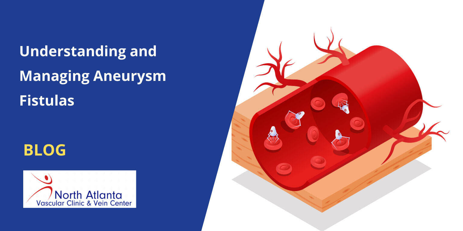 Understanding and Managing Aneurysm Fistulas