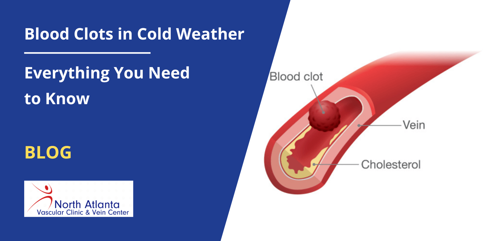 Blood circulation and cold weather