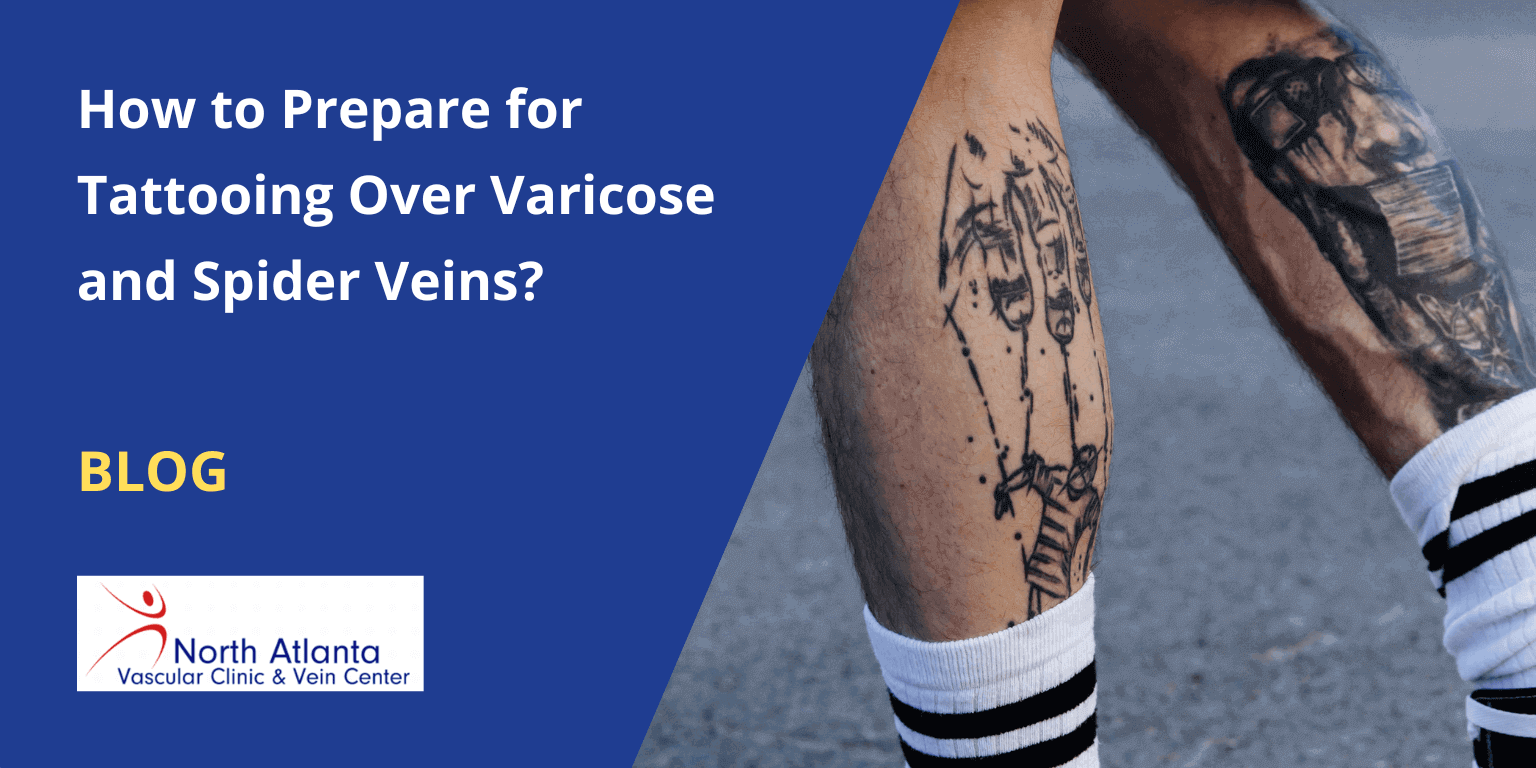 Varicose spider veins Treatment causes symptoms and more