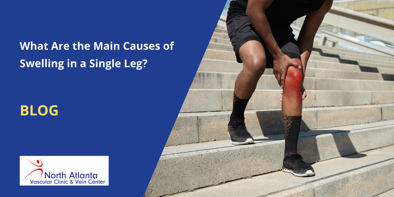 What Are the Main Causes of Swelling in a Single Leg?