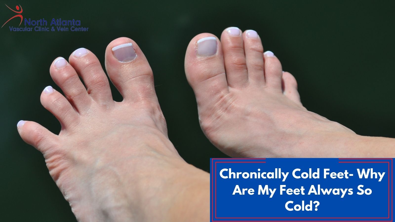 Chronically Cold Feet: Why Are My Feet Always So Cold?