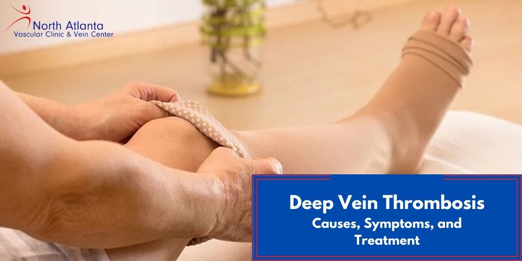 What is Deep Vein Thrombosis, and What Are the Treatments?
