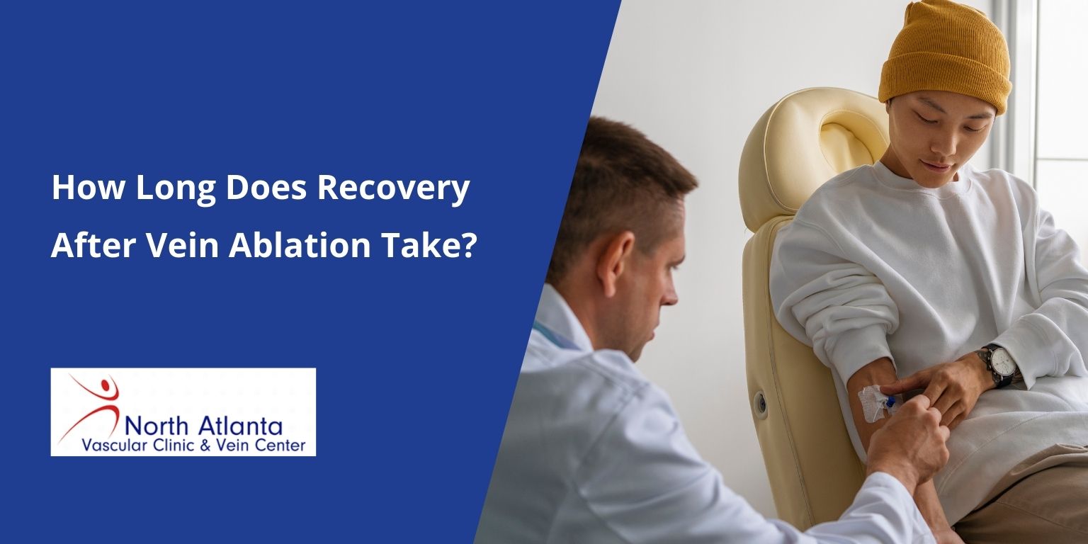 How Long Does Recovery After Vein Ablation Take?