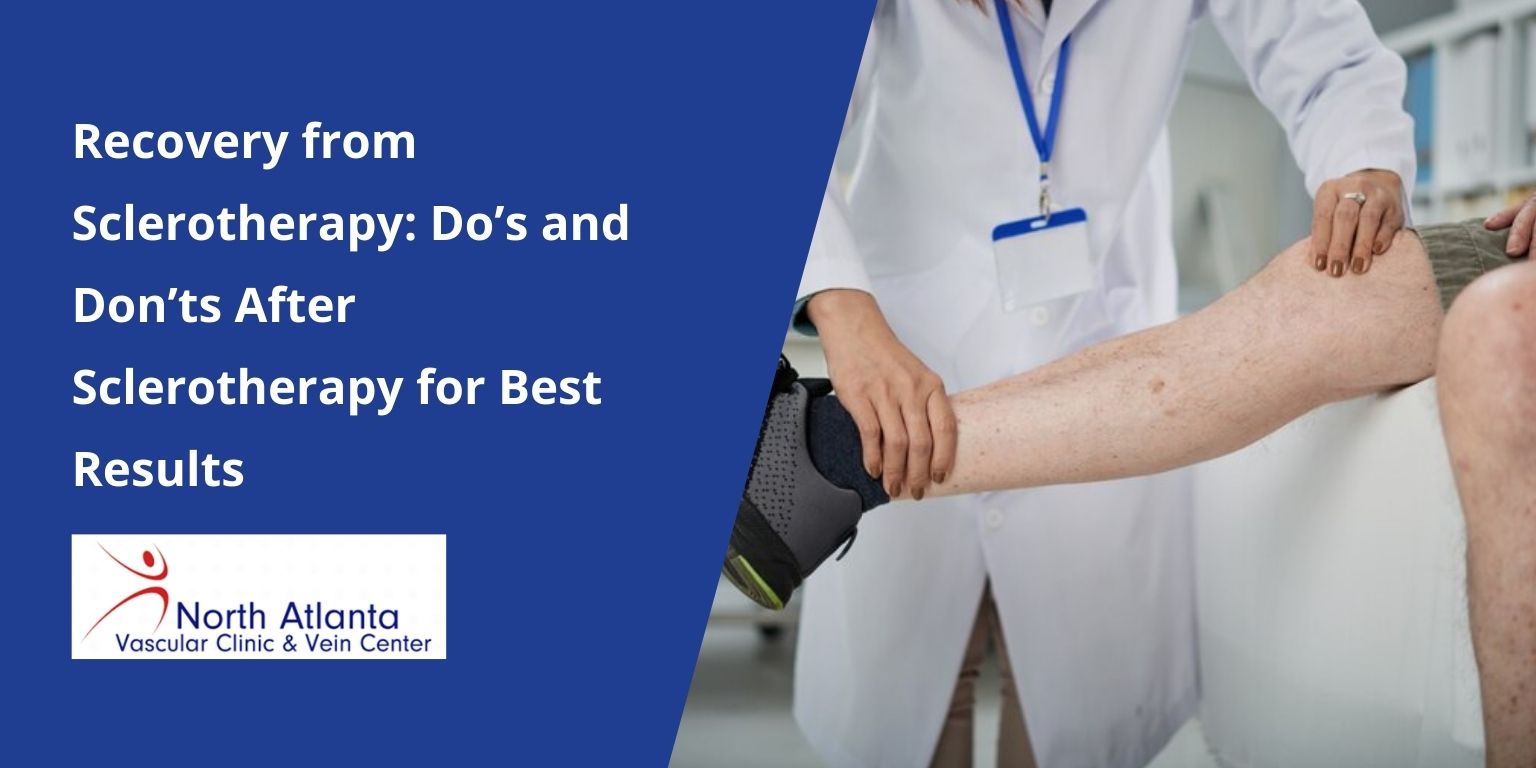 Recovery from Sclerotherapy: Do’s and Don’ts After Sclerotherapy for Best Results