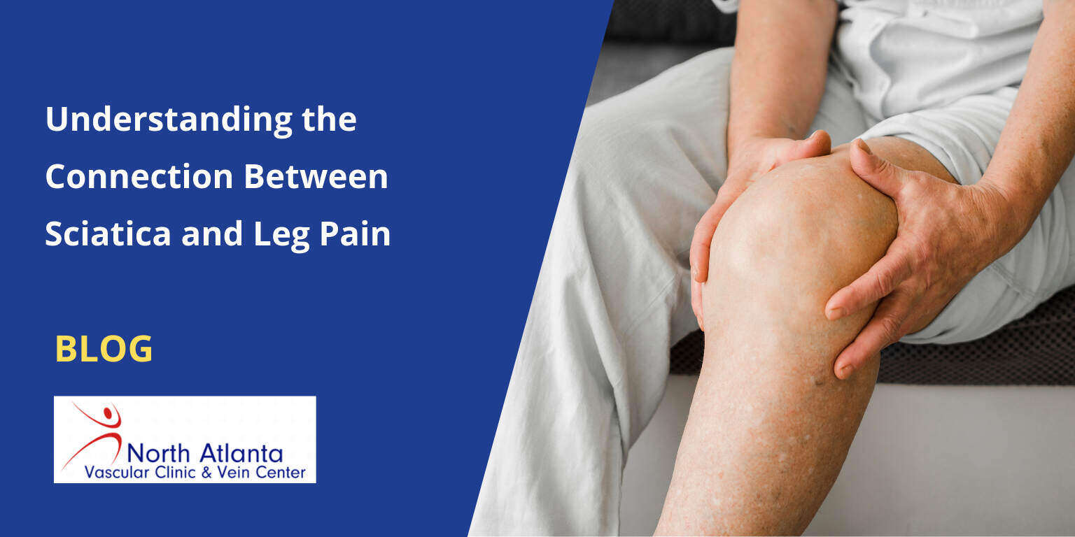 Understanding the Connection Between Sciatica and Leg Pain