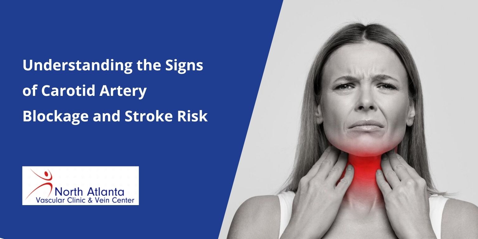 Understanding the Signs of Carotid Artery Blockage and Stroke Risk